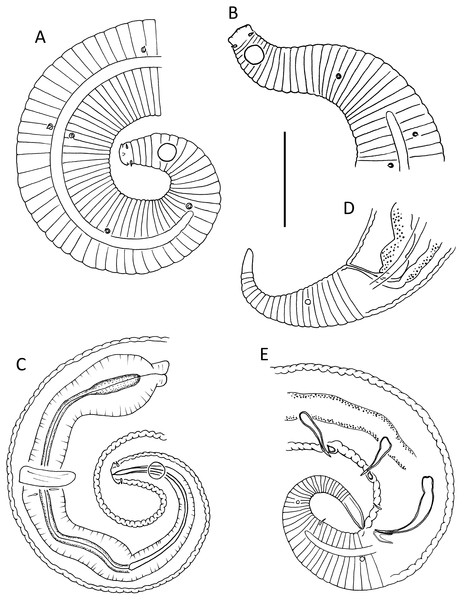 Leptolaimus dififtinus sp. nov.