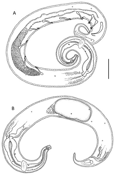 Leptolaimus dififtinus sp. nov.