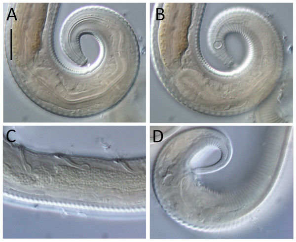 Leptolaimus dififtinus sp. nov. light micrographs of male.