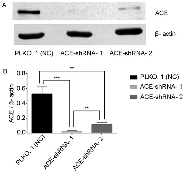 ACE protein expression was successfully silenced in HUVECs.