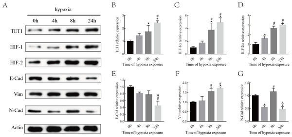 Hypoxia alters the expression of HIFs, TET1 and EMT markers.