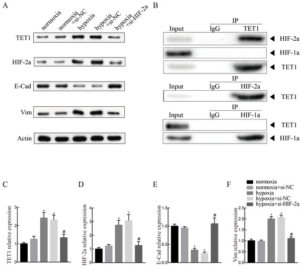 Knockdown of HIF-2α inhibits hypoxia-induced EMT and TET1 expression.