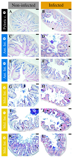 Comparison of non-infected (A, C, E, G, I, K) and infected (B, D, F, H, J, L) fish mucous cells and mucus composition in different sections of P. orbicularis GIT stained with PAS-AB 2.5.