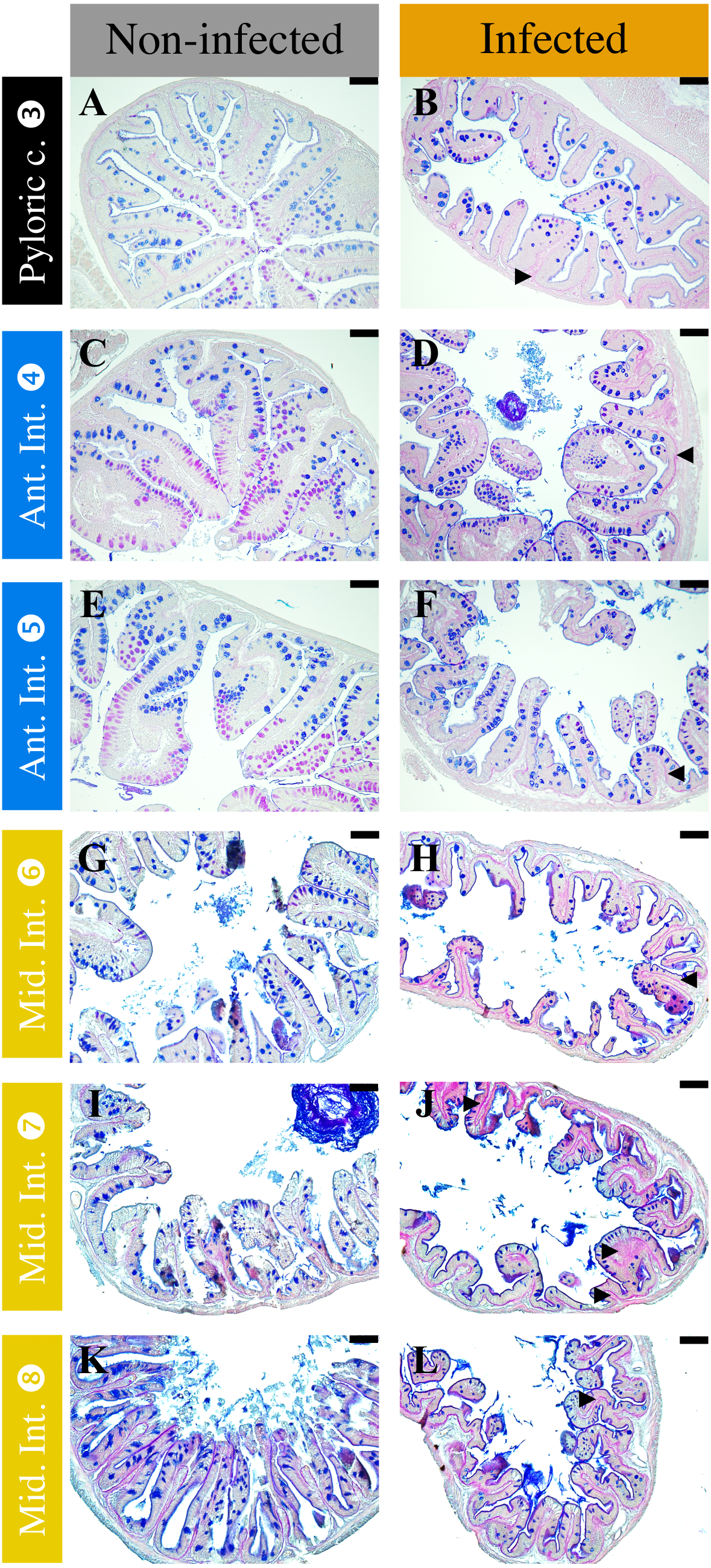 Description Of The Unusual Digestive Tract Of Platax Orbicularis And The Potential Impact Of Tenacibaculum Maritimum Infection Peerj