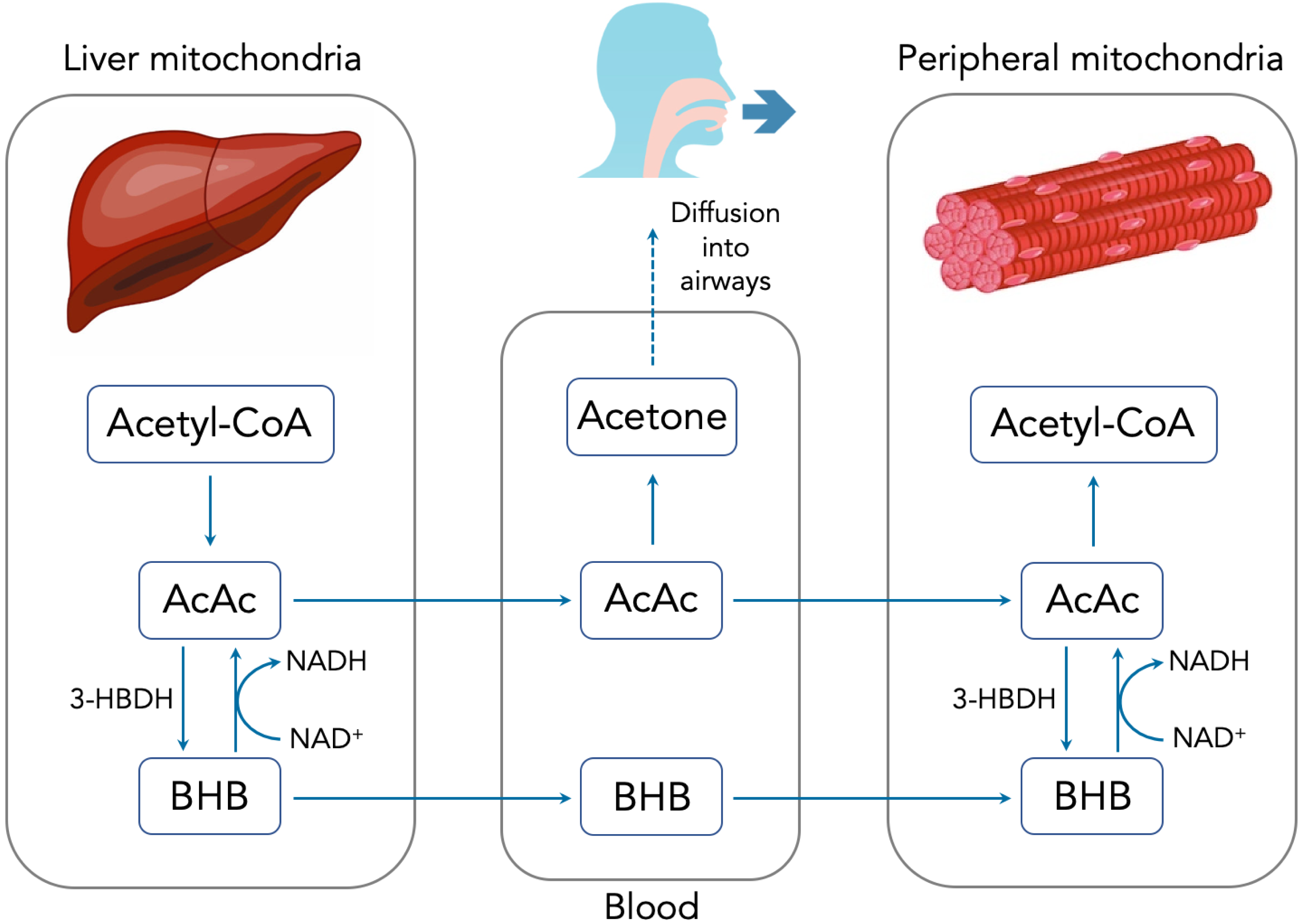 Characterization of a high-resolution breath acetone meter for ketosis ...