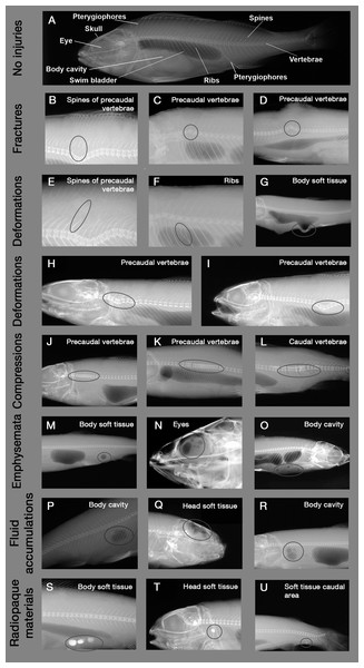 Example X-ray images of skeletal and soft tissue injuries.