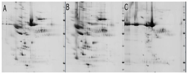 2-D gel images of plasma protein samples eluted from a ProteoExtract Albumin/IgG removal kit and concentrated using Vivaspin Turbo 4, 5 kDa ultrafiltration unit.