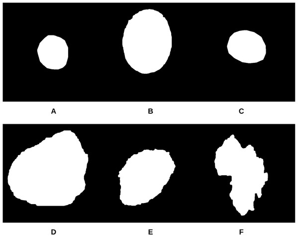 The smoothed segmented images (A–F) corresponding to the skin lesion borders shown in Fig. 11.