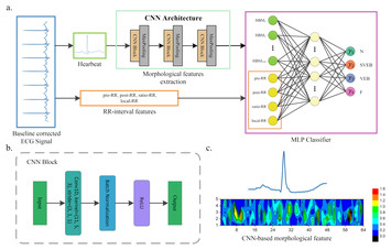 A hybrid method for heartbeat classification via convolutional neural ...