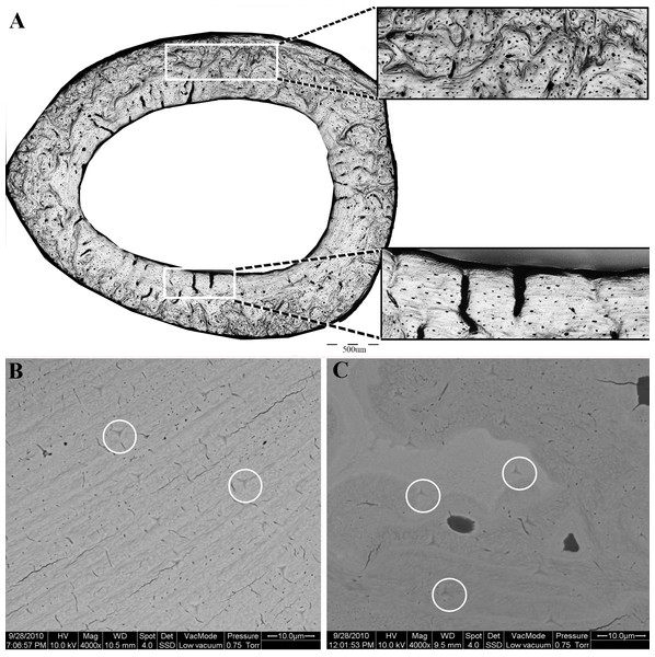 (A) Light microscopy, showing the two distinct regions of the proximal femoral cortex characteristic of both the OVH and control groups.