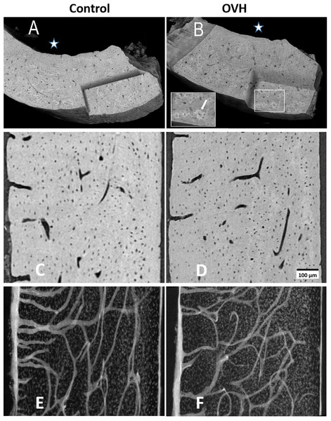 Typical views of synchrotron microCT data of control and of ovarictomized rats.