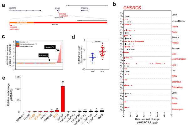 Overview of the lncRNA GHSROS and its expression in cancer.