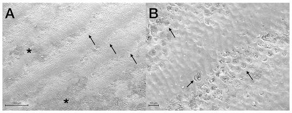 Scanning electron micrographs of a representative G1 tooth sample at (A) 400× and (B) 2,000× original magnification.