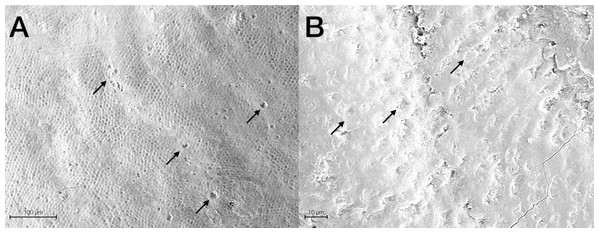 Scanning electron micrographs of a representative G2 tooth sample at (A) 400× and (B) 2,000× original magnification.