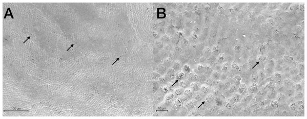 Scanning electron micrographs of a representative CONV tooth sample at (A) 400× and (B) 2,000× original magnification.