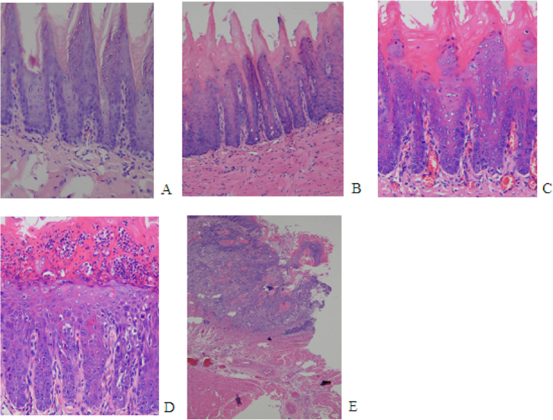 induced experimental oral carcinogenesis