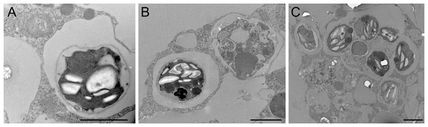 Transmission electron microscopy of intracellular algal symbionts after E. muelleri infections.