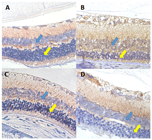 VEGF immunohistochemical staining of retinal sections ×600 in each group of rats.