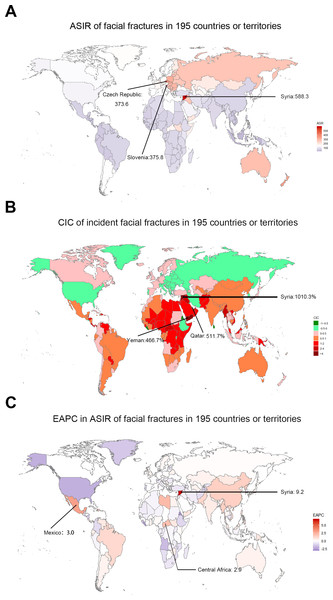 The global incidence burden of facial fractures between 1990 and 2017 in 195 countries or territories.
