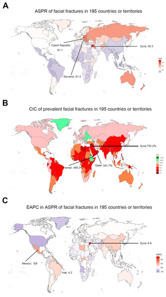 The global prevalence burden of facial fractures in 195 countries and territories.