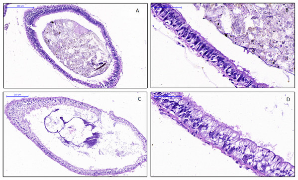 Effects of different diets on intestinal histology of Planorbella trivolvis.