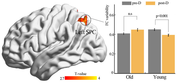 Functional connectivity variability analysis.