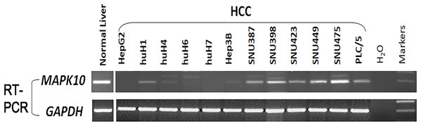Mapk10 mRNA expression in HCC cell lines.