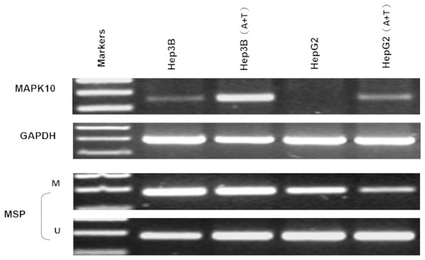 Mapk10 expression of HCC cell lines after treatment with TSA and 5-Aza (MSP: Methylation-specific PCR; M: methylated alleles; U: unmethylated alleles).