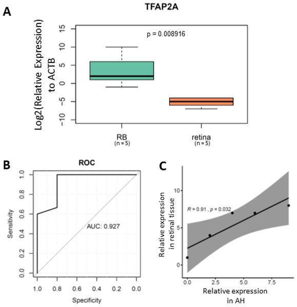 methylated TFAP2A is diagnostic biomarker for RB.