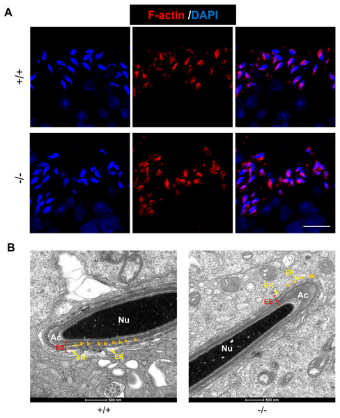 Rai14 is not required for F-actin organization.