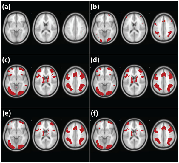 Results of analysis of the working memory fMRI images with different methods (DeYoung et al., 2009).