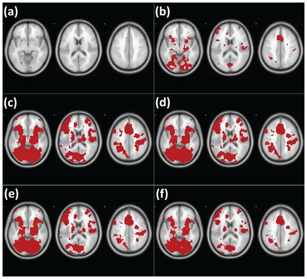 Results of analysis of the working memory fMRI images with different methods (Henson et al. 2002).