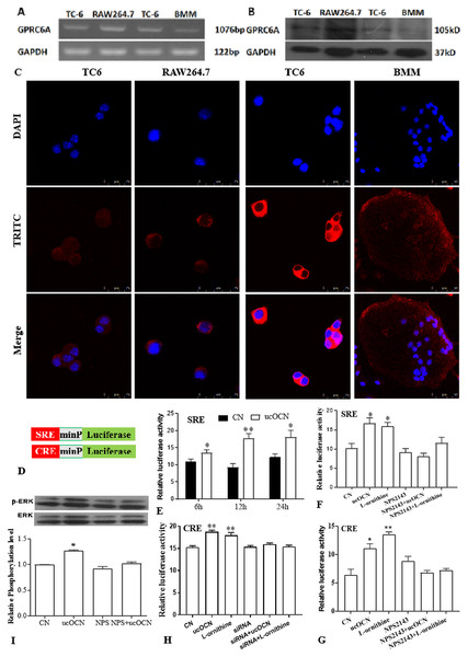Gprc6a was expressed in osteoclast and mediated the effects of ucOCN on osteoclast.