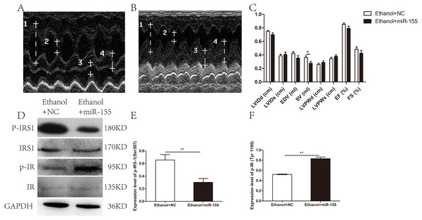 Effects of miR-155-5p upregulation on cardiac function and myocardial insulin sensitivity.