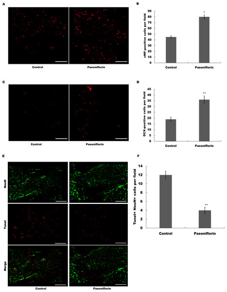 Paeoniflorin facilitated neurogenesis and vasculogenesis in rat stroke model.