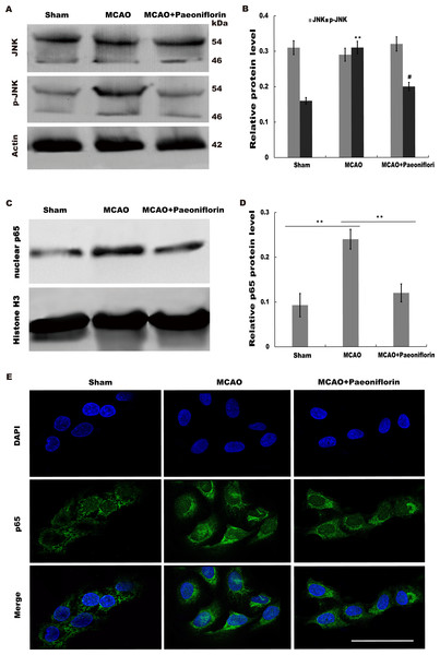 Paeoniflorin repressed JNK and NK-κB signaling activation.