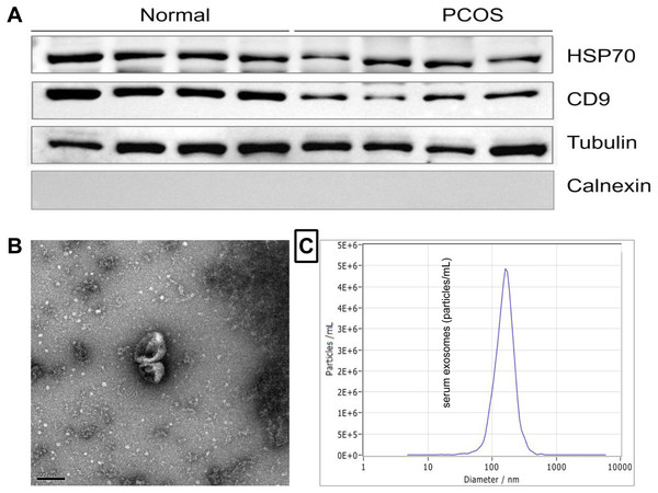 Characterization of exosomes derived from human serum.