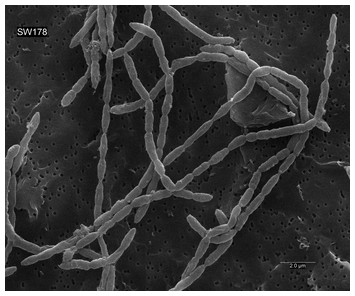 Mediterraneibacter catenae SW178 sp. nov., an intestinal bacterium of ...