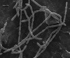 Mediterraneibacter catenae SW178 sp. nov., an intestinal bacterium of ...