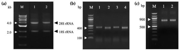 Agarose gel electrophoresis of total RNA and PCR-amplified products.