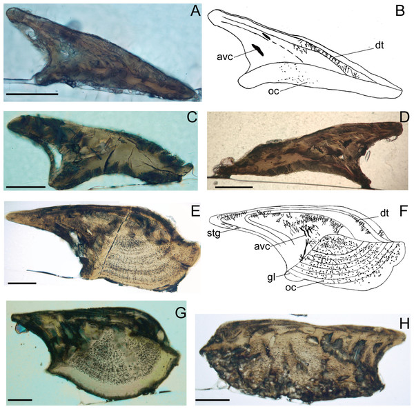 Histological microstructure and illustrative drawings of Nostolepis qujingensis sp. nov. and Nostolepis digitus sp. nov. scales in vertical longitudinal sections.