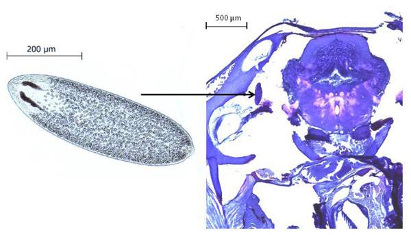The parasite Tylodelphys sp. in the cranial cavity of Galaxias maculatus.