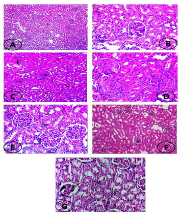 Ameliorative effect of apelin-13 against renal complications in L-NAME ...