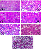 Ameliorative Effect Of Apelin-13 Against Renal Complications In L-name 