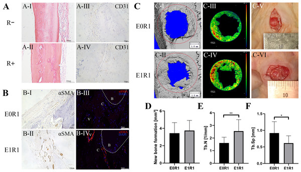 RP-Exos accelerated angiogenesis and regeneration in the bone defect model.