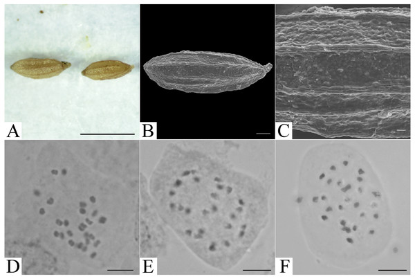 Micromorphology of achene and somatic chromosomes at metaphase of Elatostema qinzhouense.