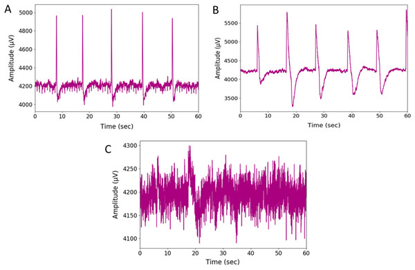 Plot of raw EEG signal (A) left-wink (B) right-wink and (C) no-wink.