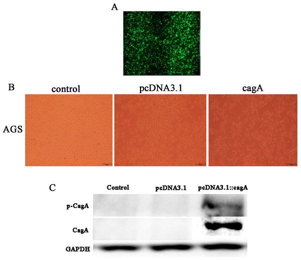 Detection of pcDNA3.1::cagA plasmid transfection efficiency and CagA expression in AGS cells.