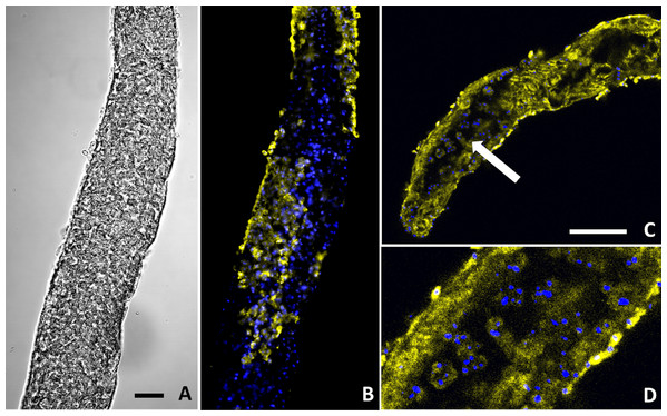 Buddenbrockia plumatellae myxoworms stained with polyclonal antibody raised towards lectin toxin.