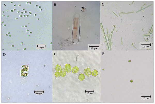 Microscopic pictures of microalgae isolated from biofloc-based system of Pacific whiteleg shrimp.